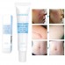 BUY EGF REPAIR GEL SCAR REMOVER CREAM - REPAIR FACE SCARS DEFENSE CREAM FOR PIMPLE, SURGICAL SCAR HYPERPLASIC SCAR, SCALDS, BURNS, ACNE MARKS AND POCKS (0.7OZ /20G) IMPORTED FROM USA