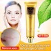 BUY ACNE SCAR REMOVAL CREAM SKIN REPAIR FACE CREAM ACNE SPOTS ACNE TREATMENT BLACKHEAD WHITENING CREAM STRETCH MARKS 30ML IMPORTED FROM USA