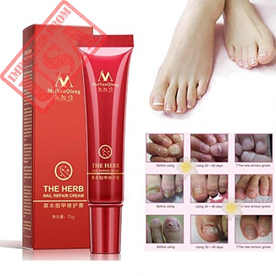 Buy RWM Foot Nail Cream Online in Pakistan