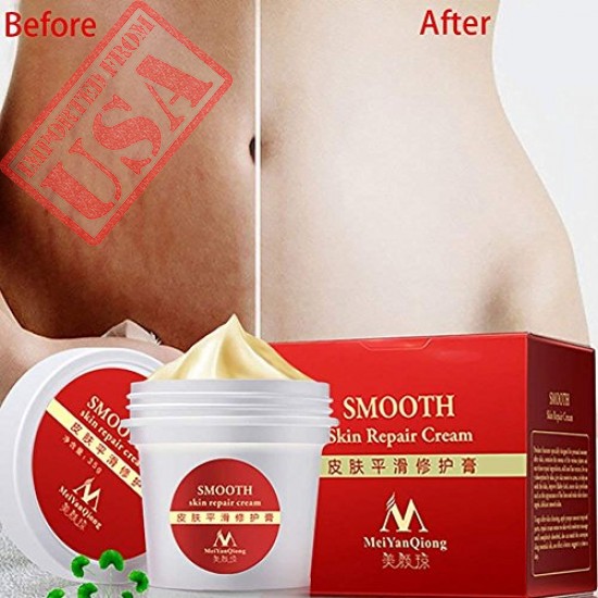 Buy EDTara Scar Removal Cream Online in Pakistan